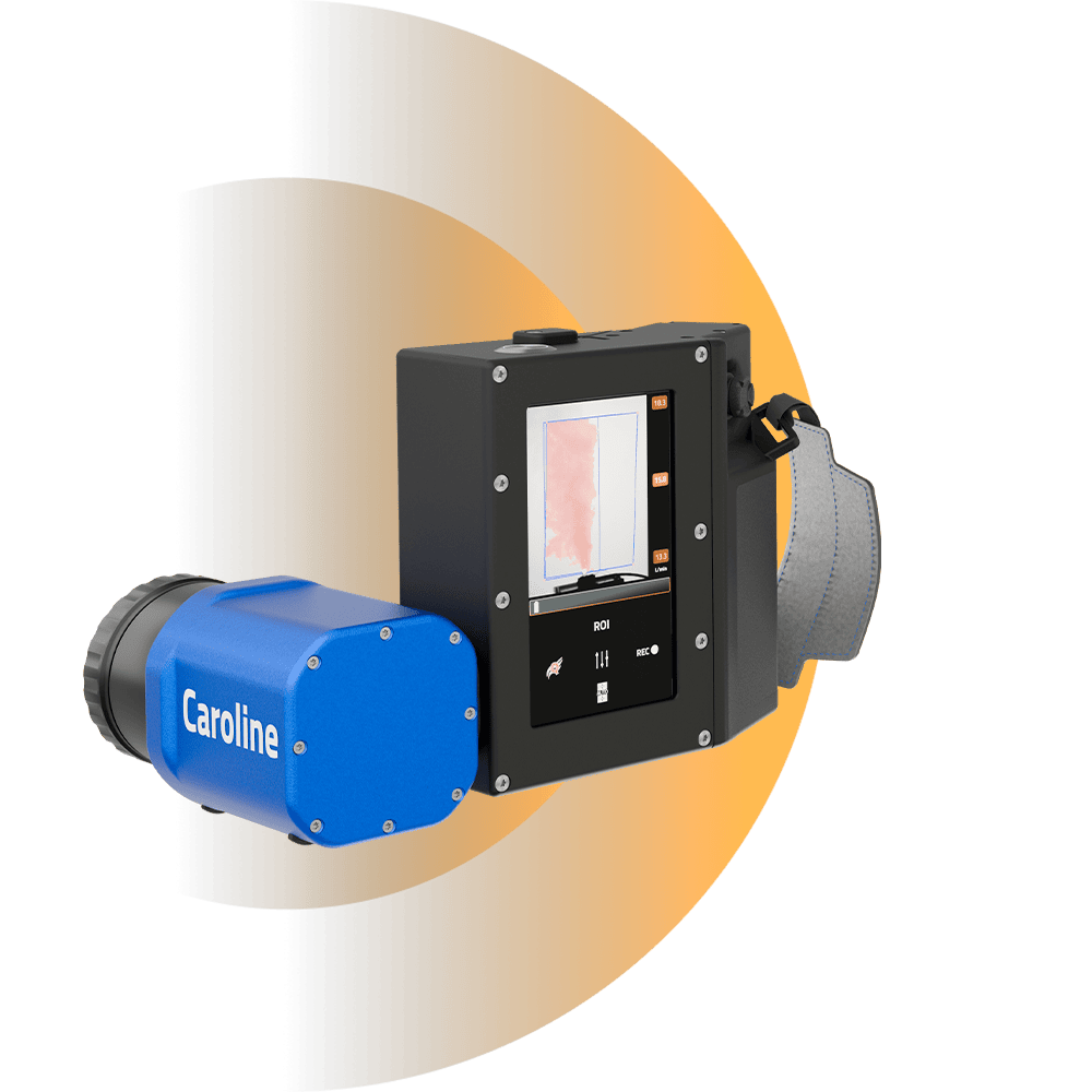 Advanced skin imaging device for precise dermatological analysis.